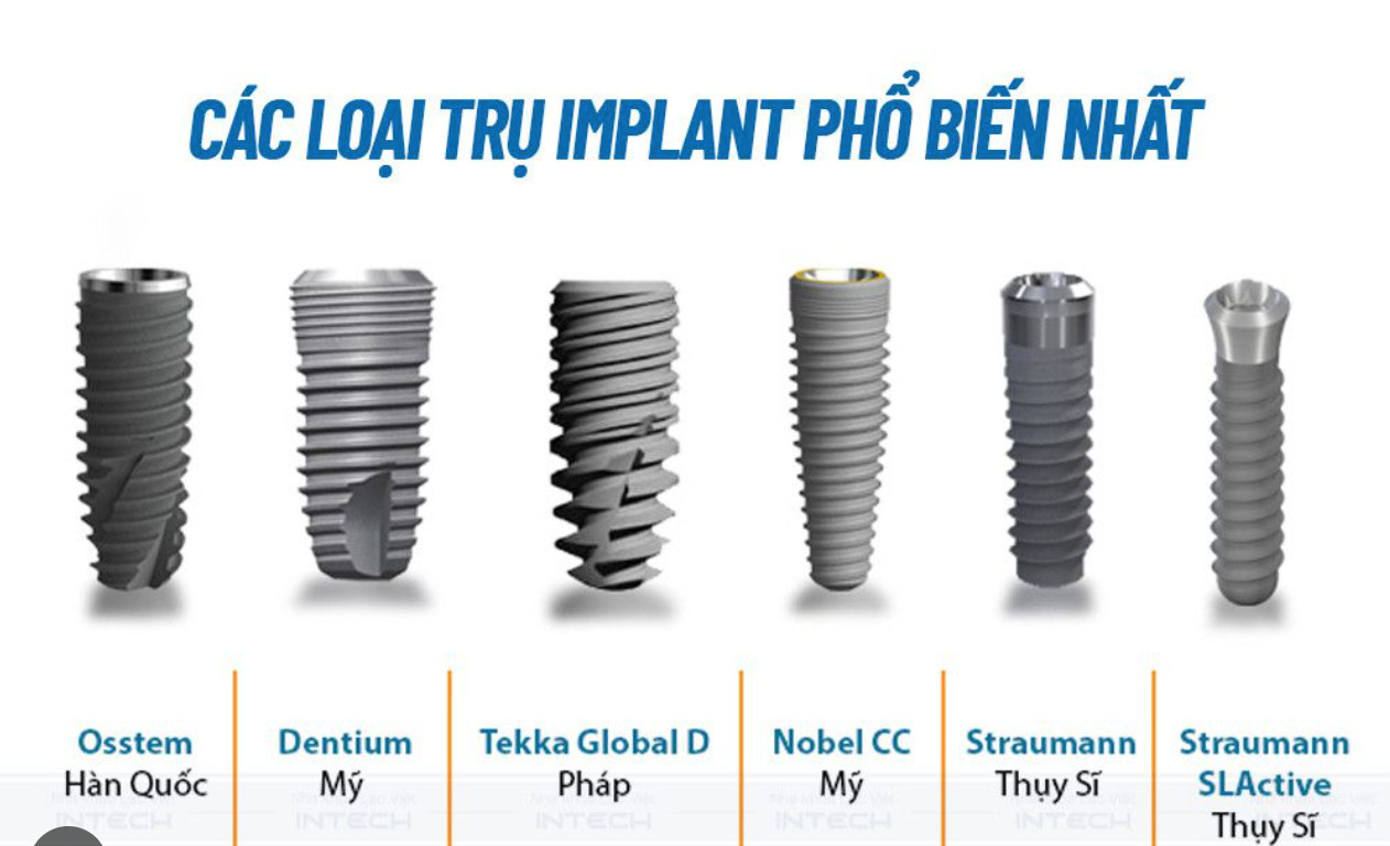 Các loại trụ Implant phổ biến