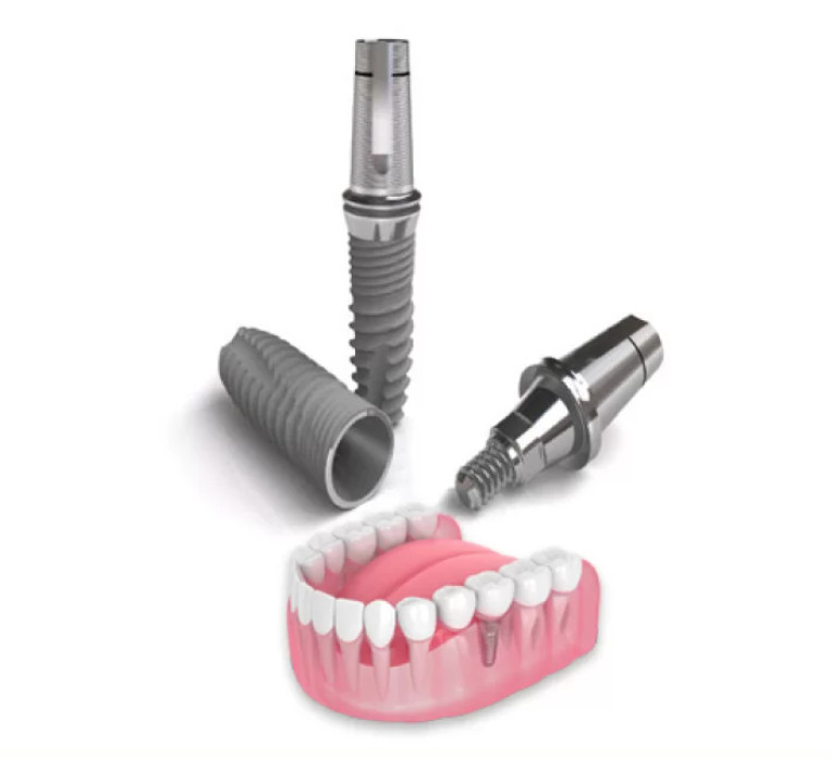 Ưu điểm trụ Implant Dentium