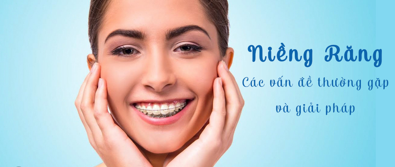 Các vấn đề thường gặp khi niềng răng