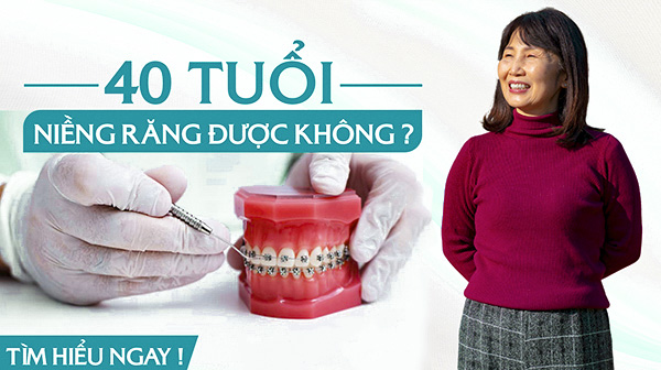 40 tuổi có niềng răng được không