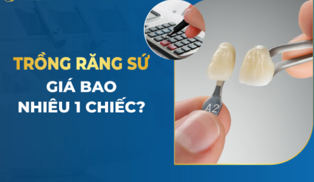 Giá bọc răng sứ trọn gói