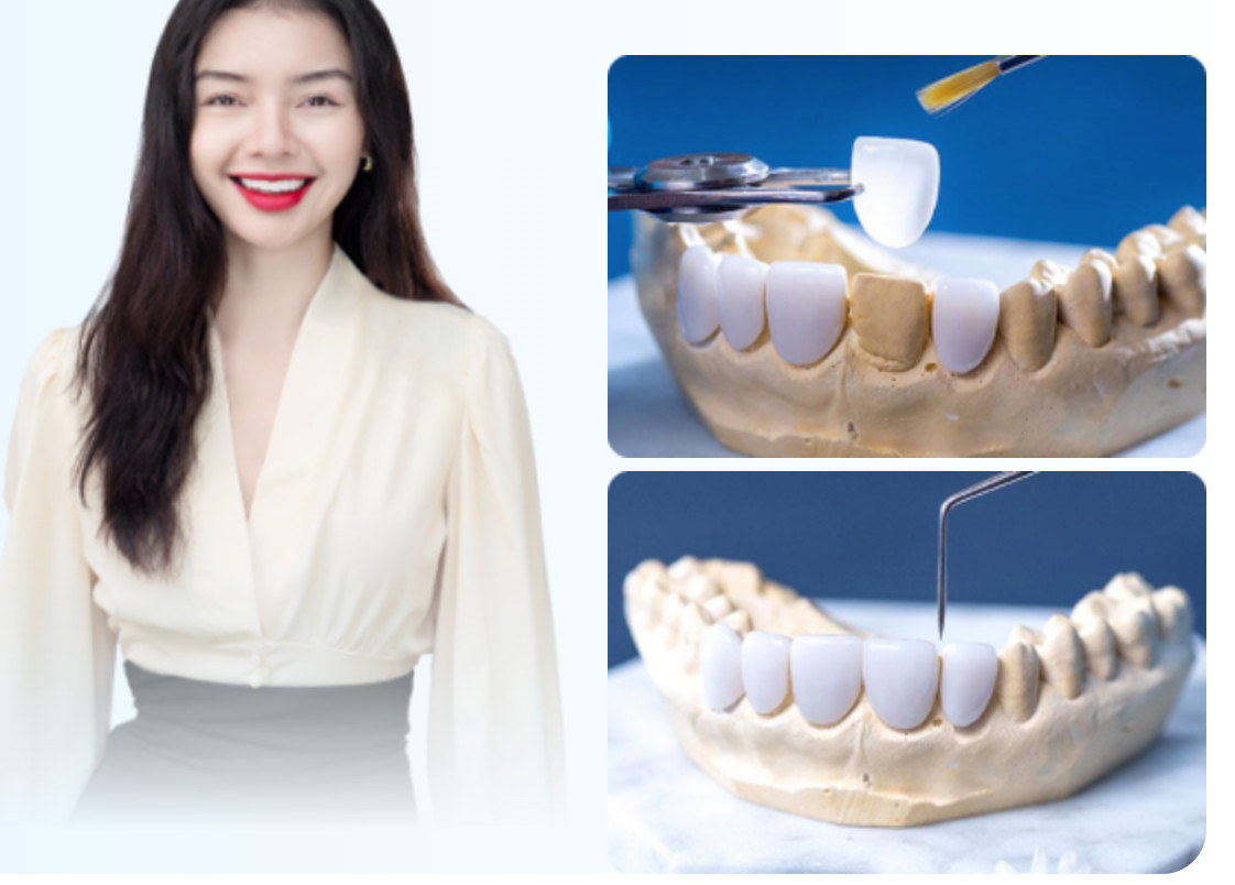 Răng toàn sứ ZIRCONIA