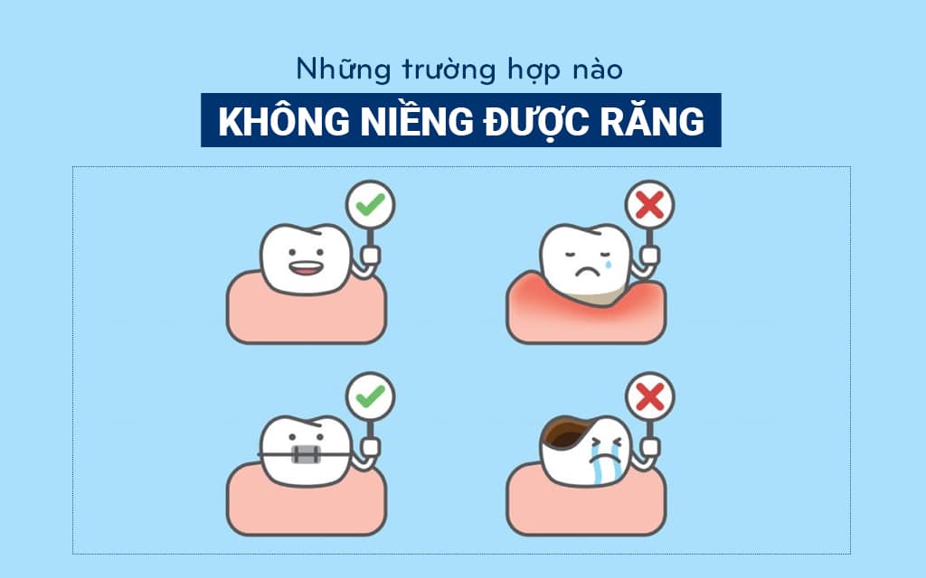 Những trường hợp không nên niềng răng