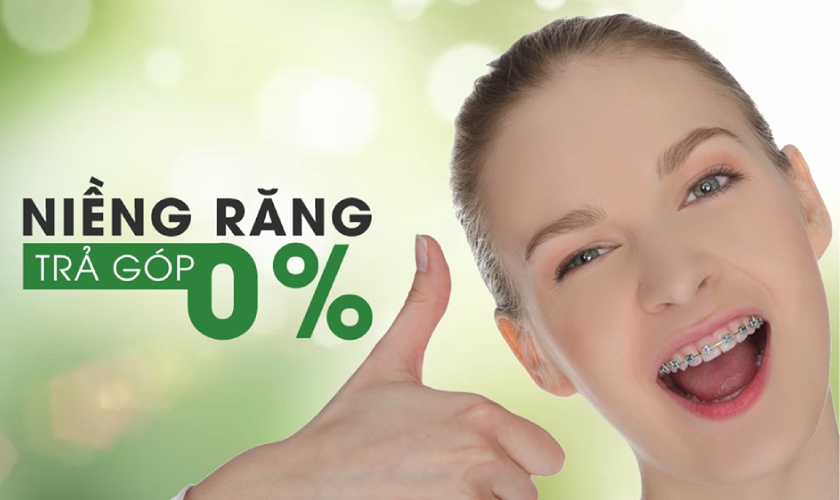 Niềng răng trả góp