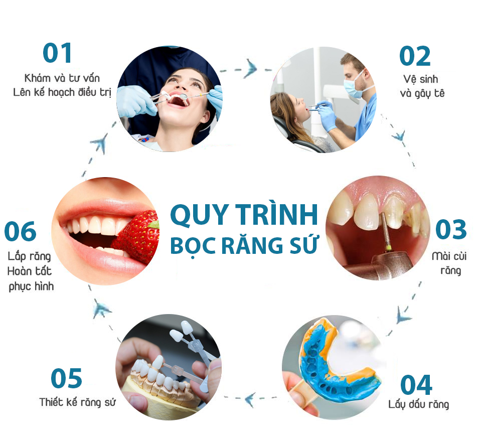 Quy trình bọc răng sứ đúng chuẩn