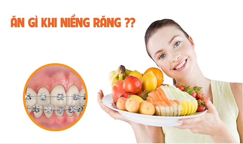 Khi niềng răng cần ăn gì?