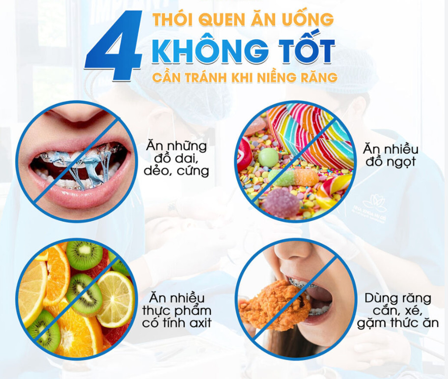 Những loại thức ăn cần tránh khi niềng răng