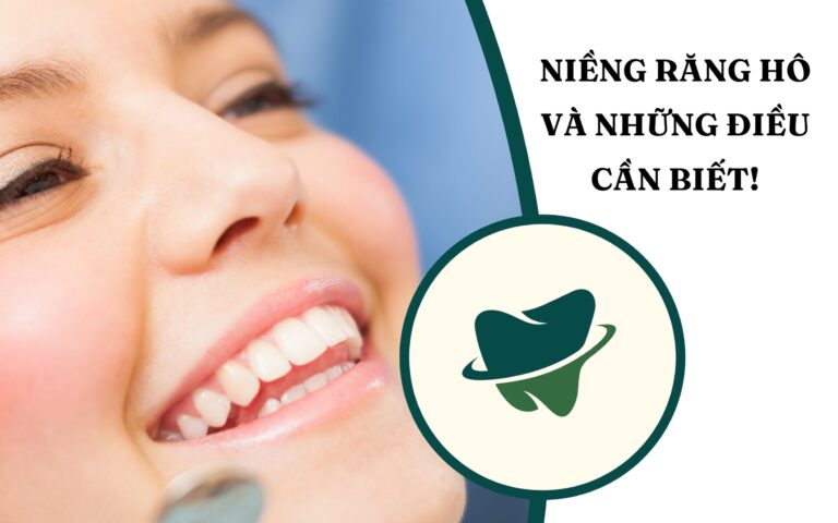 Niềng răng hô