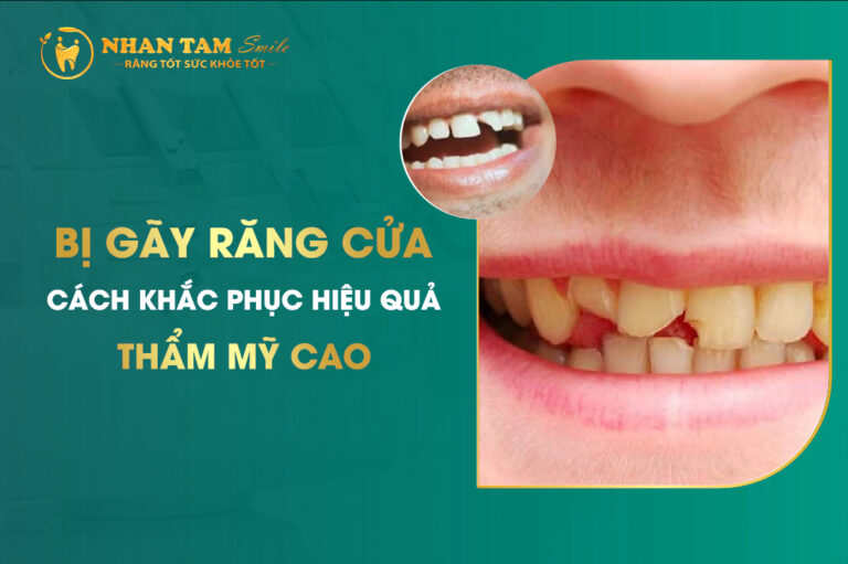 gãy răng cửa