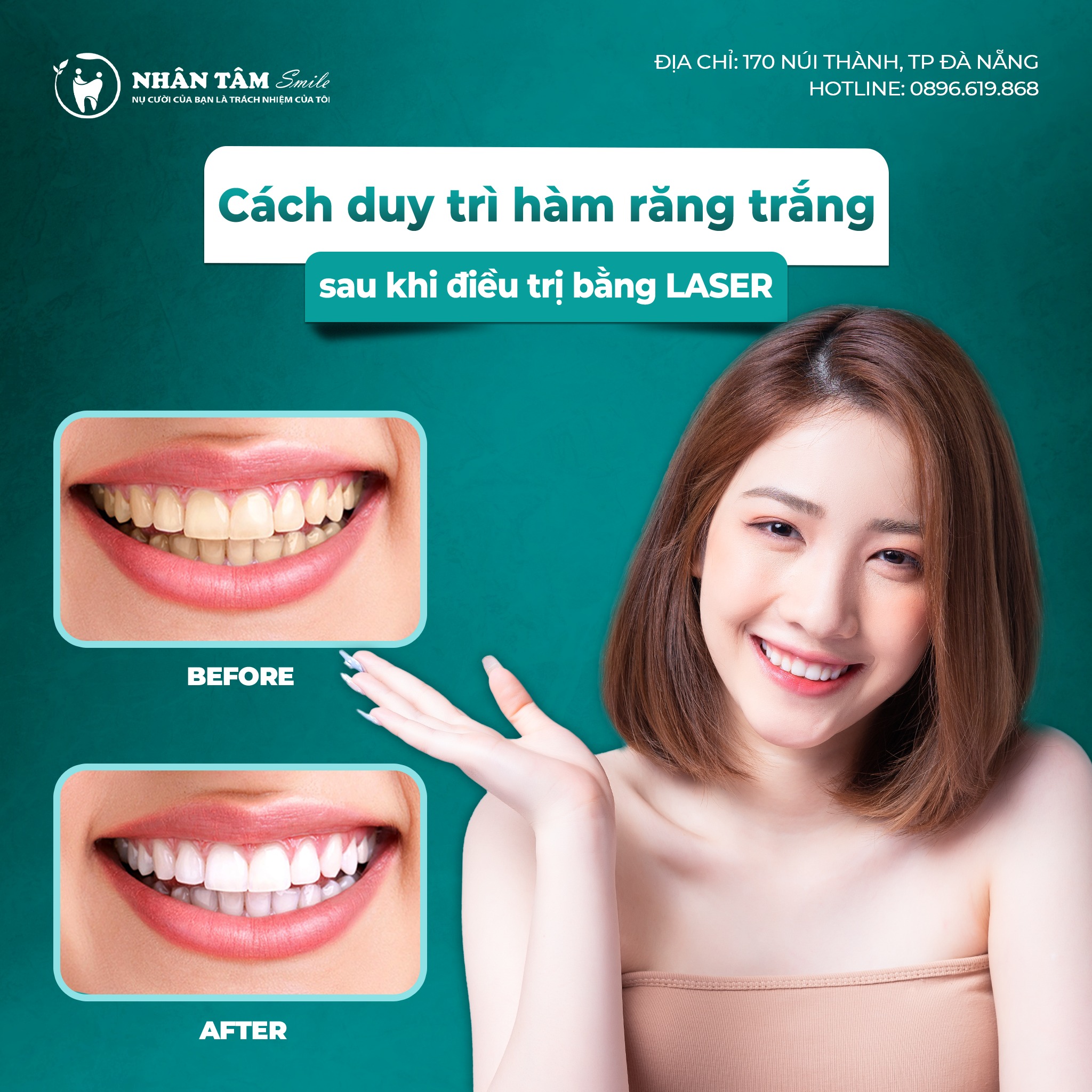 phương pháp điều trị trắng răng bằng tia laser